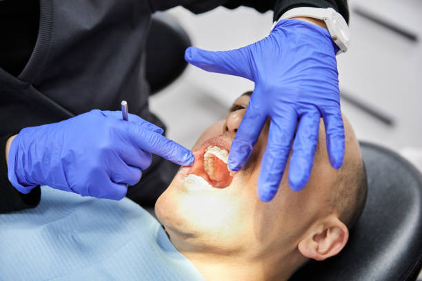 Best Emergency Root Canal Treatment in Monterey Park, CA